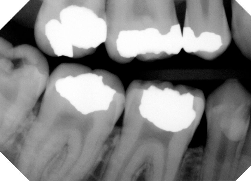 Direct USB Digital radiography sensor with a demo of Choice Imaging 